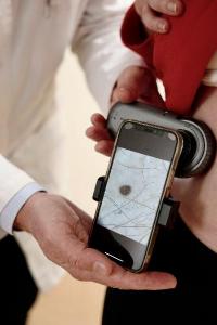 Vyšetření pigmentových znamének